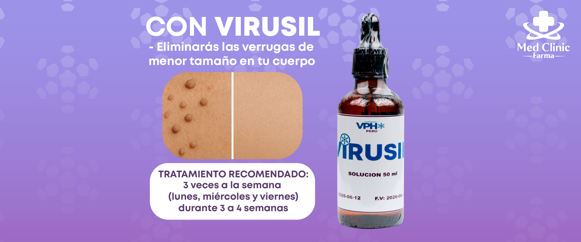 VIRUSIL imagen 3